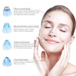 Elektroninis veido porų valiklis "Luxury Peeling Beauty 2"