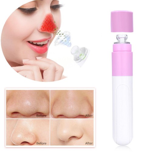 Elektroninis veido odos ir porų valiklis "Spartuolis 6"